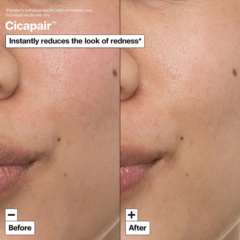 Cicapair™ Intensive Soothing Repair Cream - Image 10