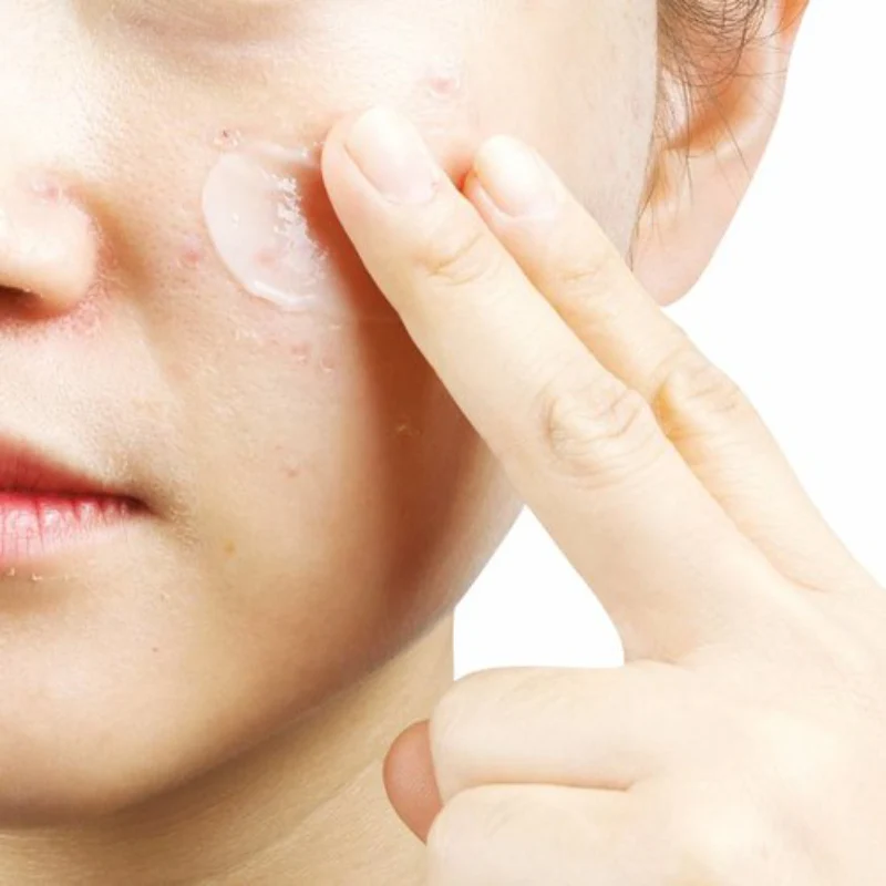 Anti-T Cream - Image 2